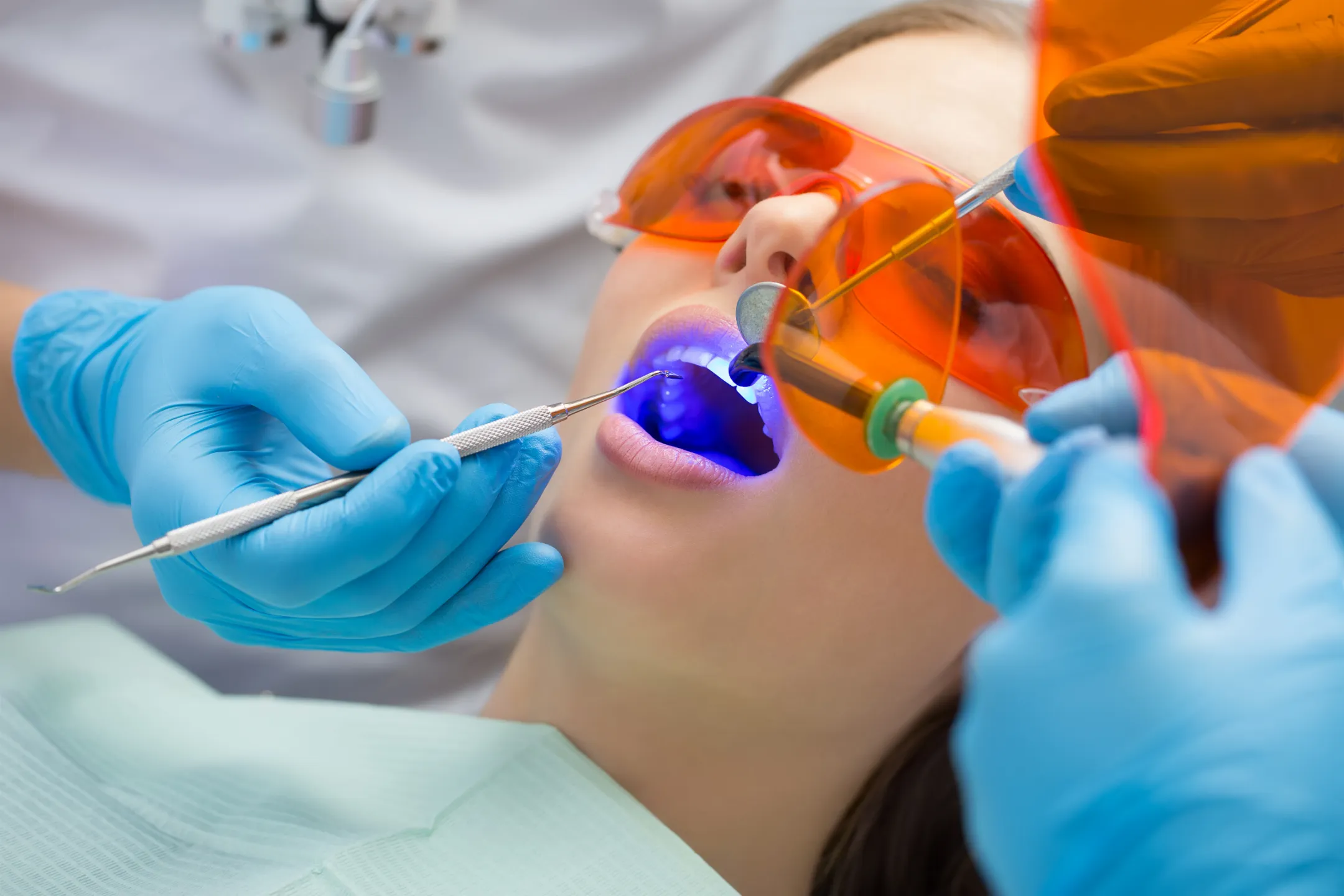 Dental Fillings
